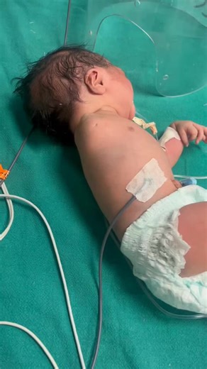 ‏Baby with congenital Birth defect.. very Sad😥 | birth defect