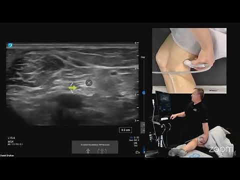 Ultrasound Evaluation of the Medial and Lateral Knee