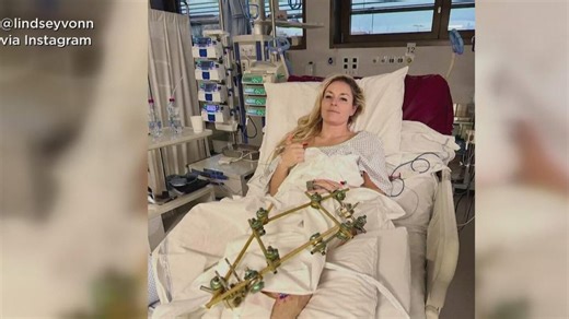 Olympic skier Lindsey Vonn out of hospital; thanks doctor for saving her life