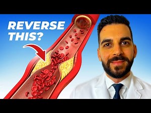 The Truth About Nattokinase For Heart Health