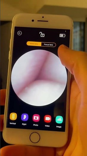 Revolutionary Ear Cleaning Tool with Camera! | Smart Ear Wax Remover Demo