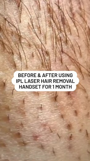 RoseSkinCo on TikTok