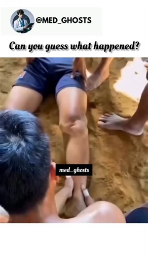 Medical Insights on Instagram: "A dislocated knee happens when the bones are forced out of their natural alignment, usually from sports injuries, accidents, or sudden twists. It’s an extremely painful condition, and if not treated properly, it can damage nerves and blood vessels around the joint. Doctors carefully manipulate the knee back into position — a process called reduction — often followed by scans, braces, and physical therapy. It’s not something to try at home, but understanding the sc