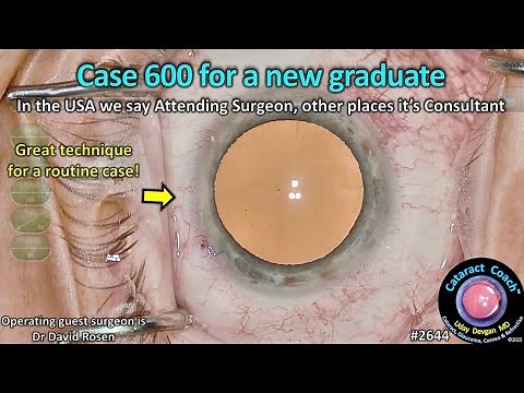 CataractCoach™ 2644: case 600 for a new graduate