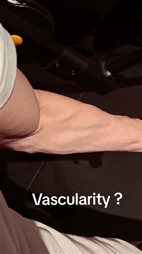 Vascularity