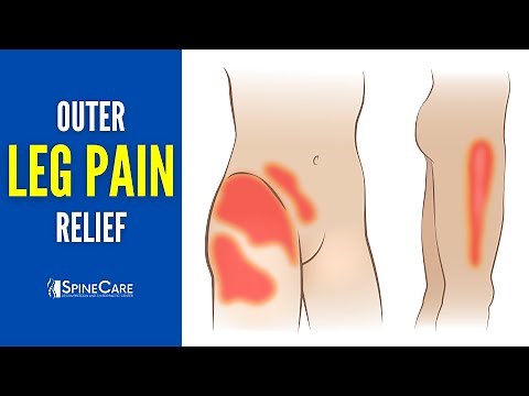 How to INSTANTLY Relieve Outer Leg Pain