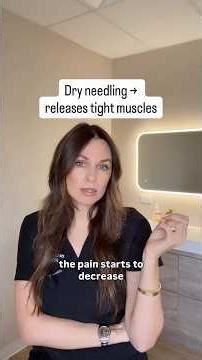 Dry Needling vs Acupuncture vs Motor Point Explained