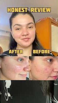 Trying the viral K beauty products, The link of the product is in my YouTube videos description ￼￼