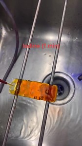 Gram stain😍😍 # #MLT #fblifestyles #diagnostics #LabTechnician #parasite #Microbiology #lablife | Lab life