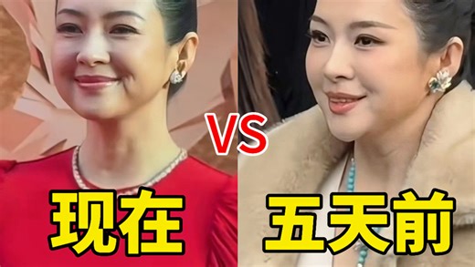 天呐！章子怡的脸又再次冲上热搜对比前几天又肿胀了！此前被议论做了医美填充还没消肿！网传为新电影角色主动增重20斤！网友辣评还以为是回春的倪萍…