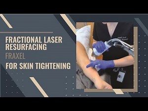 Fractional Laser Resurfacing | Fraxel | For Skin Tightening | West Hollywood, CA | Dr. Jason Emer