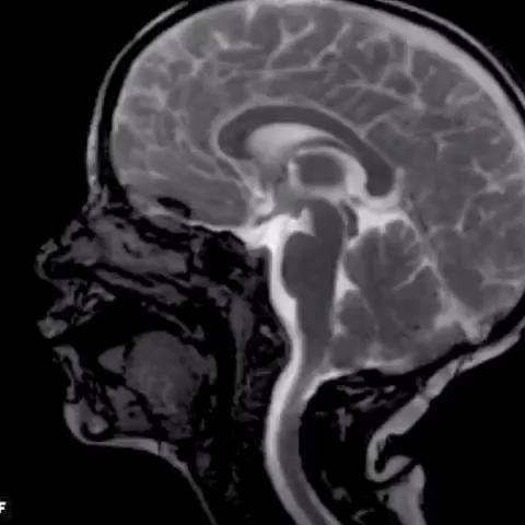 Your brain in movement, pulsating with every heartbeat. Video by Itamar Terem, Stanford University, Palo Alto, CA, and Samantha Holdsworth, University of Auckland, New Zealand | IFLScience