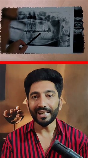 Boy Dies After Chewing Gum Suddenly Explodes