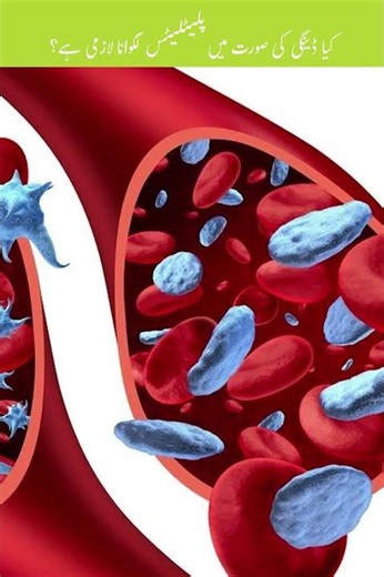 Why is Platelet Transfusion So Difficult in Dengue? | Doctor Explains
