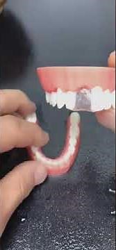 Temporary Tooth Repair Kit-