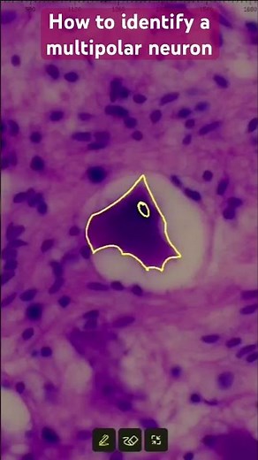 “How to Identify a Multipolar Neuron in Seconds!” 🔬 #short #histology