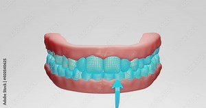 3d animation of neon mesh protection of stylized teeth, mouth, getting rid of yellow plaque, harmful bacteria, tartar, caries development, teeth whitening. bacteria attack tooth enamel
