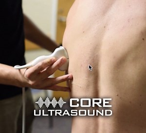 How to Perform a Pulmonary Ultrasound Exam - Core Ultrasound