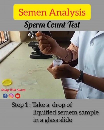 “Semen Analysis: What's Your Sperm Count?” Understanding Semen Analysis: Sperm Count, Motility#lab