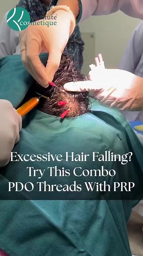 Excessive Hair falling? Try this combo PDO threads with PRP The PRP therapy enhances the growth factors that stimulate hair growth, improving hair thickness and density, and reducing hair shedding , while the PDO threads create a scaffolding effect that supports the growth of new hair follicles. The combination treatment can be particularly effective for individuals with more advanced hair loss or thinning hair. At Cosmetique, all our doctors are US qualified and have years of experience in the 