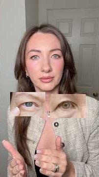“GET BLEPHARO- YOUR HOODED EYES SUCKS!” 😱😱😱😱
