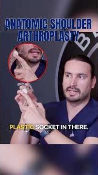 Anatomic Shoulder Replacement: What Actually Happens
