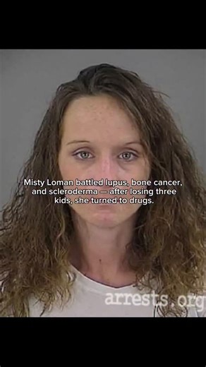 Slide to feel on Instagram: "Misty Loman’s life was marked by unbearable pain and tragedy. She suffered from lupus, bone cancer, and scleroderma — diseases that slowly changed her appearance and caused immense physical pain. But her greatest heartbreak came when she lost two of her children at birth, and another shortly after. The grief shattered her, leaving deep emotional scars that no medicine could heal. In an attempt to escape the pain, she turned to drugs, which only worsened her condition