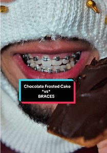 Chocolate frosted cake vs braces — easy clean with a water flosser