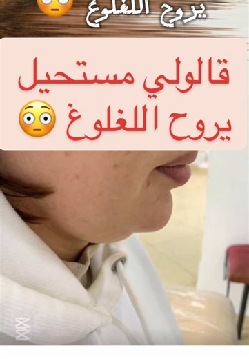 Pour toutes prises de rendez-vous veuillez nous contacter via : 📞05.53.32.15.73 📞07.75.89.88.03 #wasaclinic #medical #wasa #beautiful #dz #beauty #alger #algeria #esthetique #lipolyse #ذقن_مزدوج