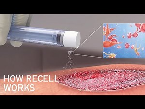 How RECELL® Works: Spray-On Skin™ Cells for Wounds