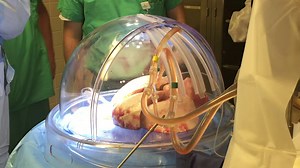 #OSUWexMed's Comprehensive Transplant Center was the first in Ohio to test a new process called Ex-Vivo Lung Perfusion (EVLP), a mechanical system that respirates, warms, nourishes and repairs donor lungs outside of a human body, improving the likelihood that they can be used in a lifesaving transplant. Details: http://go.osu.edu/Cukb #tbt | The Ohio State University Wexner Medical Center