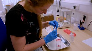 Human Subcutaneous Adipose Tissue Sampling Using a Mini-Liposuction Technique