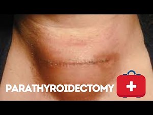 Parathyroidectomy