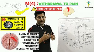GCS M4 INTERPRETATION : NEUROPHYSIOLOGY AND TREATMENT TIPS FOR M4 MOTOR RESPONSE PATIENTS
