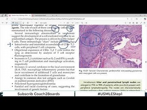 Chp#13 Robbins Patho | Lung Pathology | SARCOIDOSIS | Restrictive Lung Disorders | Lung Pathology