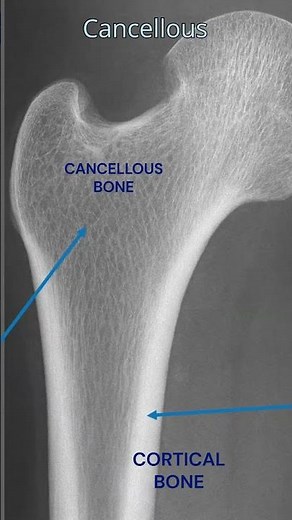 Cortical vs Cancellous Bone 🦴 | X-ray Difference Explained #radiography #xray #medicalimaging
