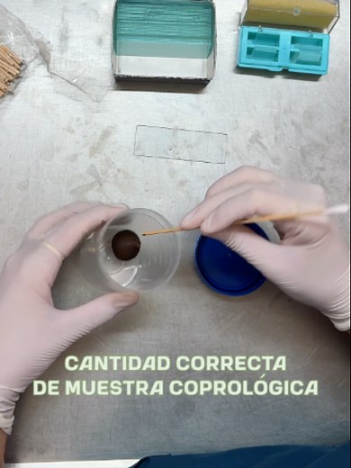 Ni mucho, ni poco: la cantidad correcta importa más de lo que imaginás. 👀 En este reel te mostramos cuánto material necesitás realmente para una muestra coprológica. Mirá hasta el final y evitá errores que pueden complicar el estudio. 💡 #Laboratorio #MuestraCoprológica #Coproparasitológico #Prevención #Porteña #parati #fyp