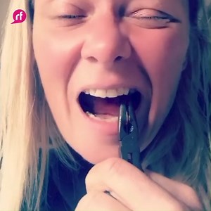 8 comments | WATCH: Woman turns to DIY dentistry! This is not for the faint hearted  https://www.real-fix.com/videos/watch-woman-turns-to-diy-dentistry/ | Real Fix | Facebook