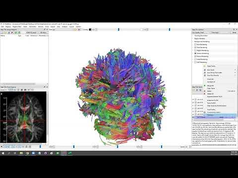 DSI Studio Workshop (Oct 21 2022) Wk7: Correlational Tractography