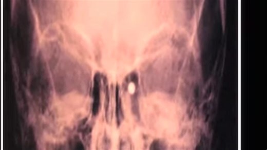 14K views · 245 reactions | Forensic #forensicfiles #science #forensicscience #forensics | Forensic File Cases | Facebook