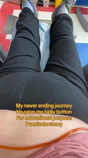 Tainamomof4 (@taishtainaguzman)’s video of vertical bellybotton