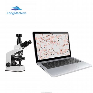 [Hot Item] Portable Automatic Sperm Quality Analyzer for Male Semen Testing