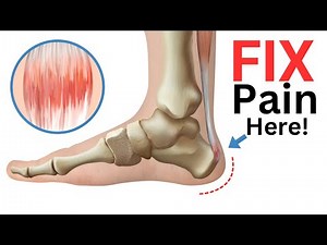 4 Exercises to Fix Achilles Tendonitis FAST!