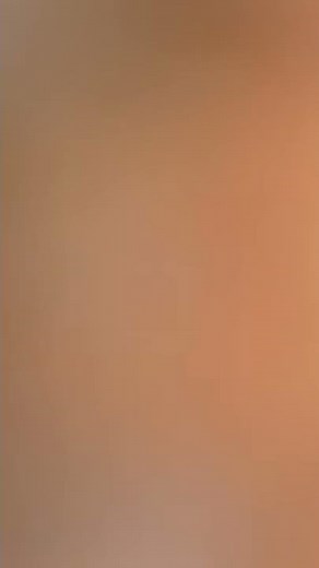 epic diarrhea form prune juice