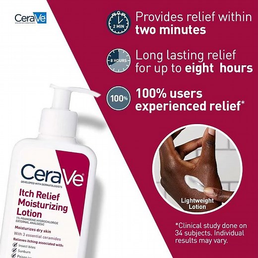 🔥 CeraVe Anti-Itch Lotion Review | Fast Relief for Dry, Itchy Skin