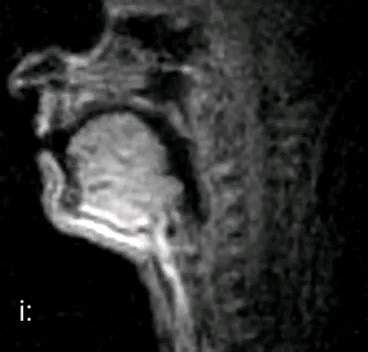 英语语音笔记5:英语国际音标/i:/ /ɪ/ /e/ /ɛ/ 发音对比&词典中/i:/与/i/的区别