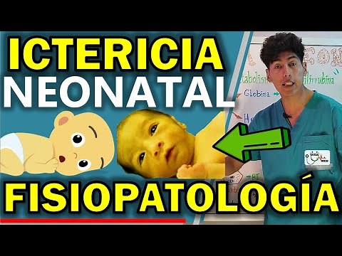 ICTERICIA NEONATAL FISIOPATOLOGÍA | GuiaMed