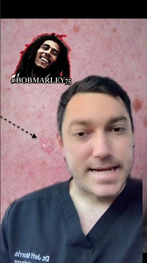 Talking about Clear Melanoma (Amelanotic Melanoma) - TikTok SkinDoc