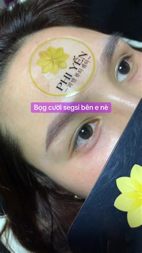 Xu hướng làm đẹp tự nhiên với filler và botox