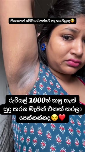 කලු තැන් සුදුකරන්න මැජික් ක්‍රීම්